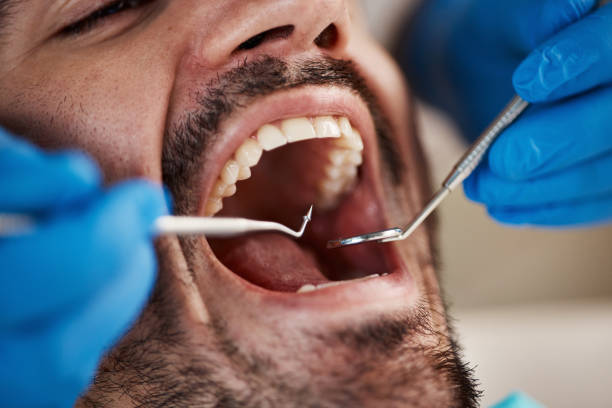 Best Emergency Treatment for Toothache in Kinnelon, NJ